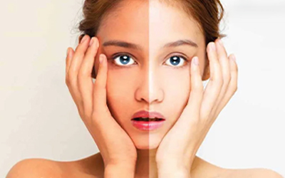 Now skin whitening become easier in just one session